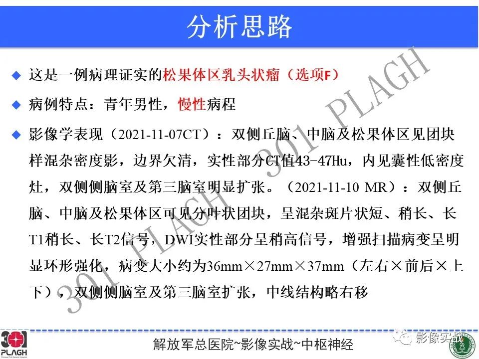 影像PPT - 【病例】松果体区乳头状瘤1例CT及MR-17