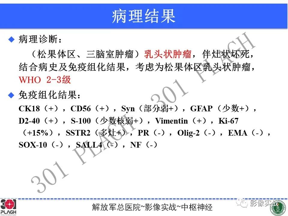影像PPT - 【病例】松果体区乳头状瘤1例CT及MR-25
