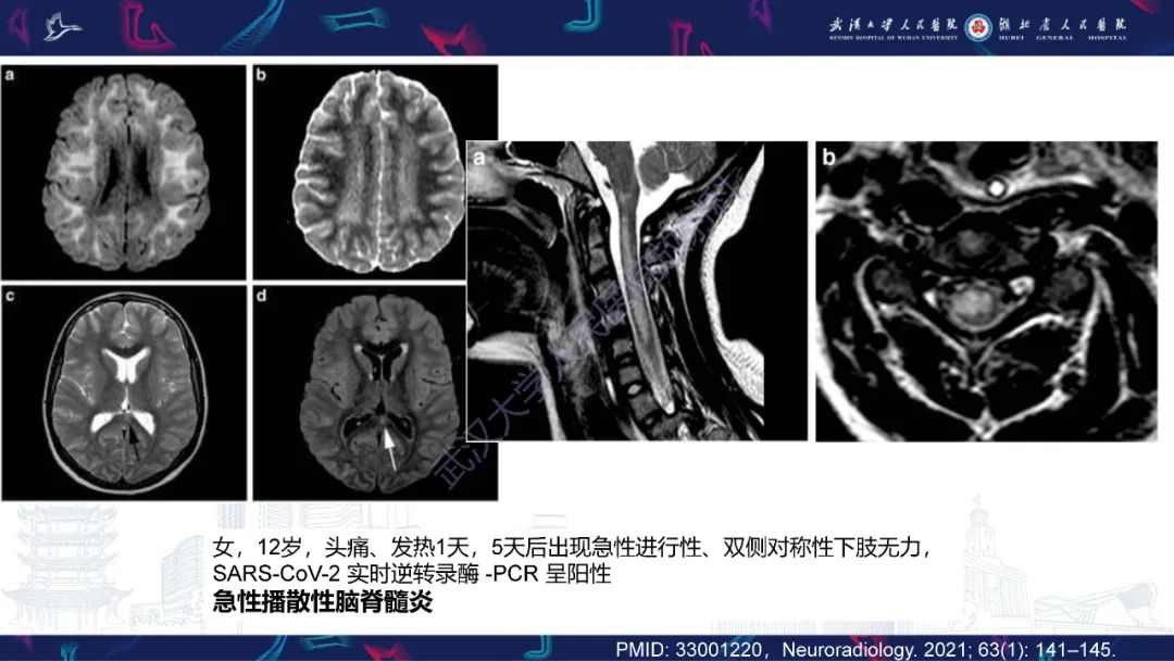 影像PPT - 【PPT】维生素B12缺乏神经影像诊断-36