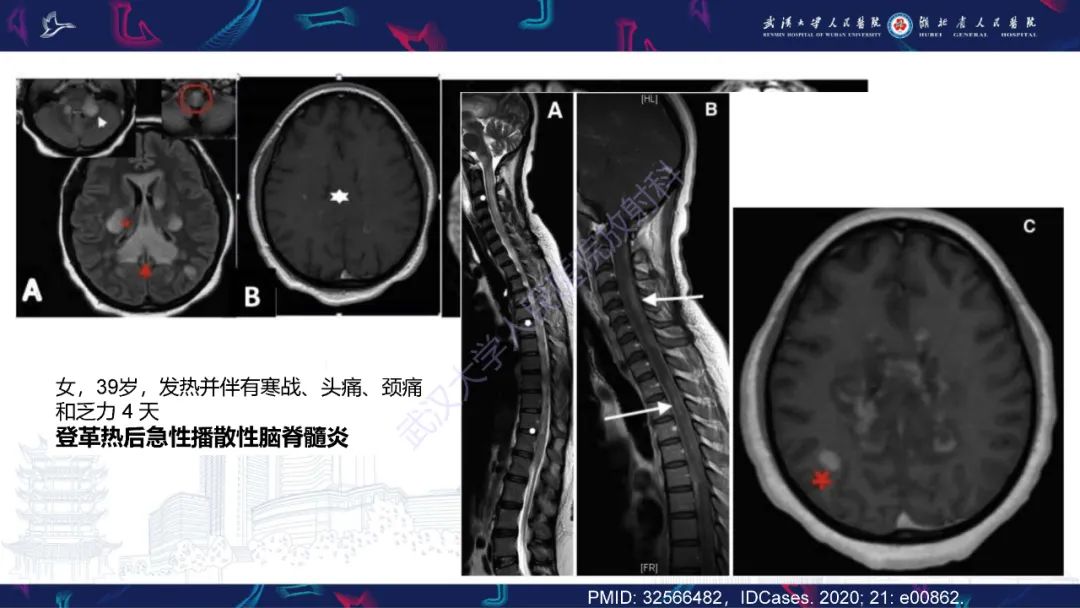 影像PPT - 【PPT】维生素B12缺乏神经影像诊断-37