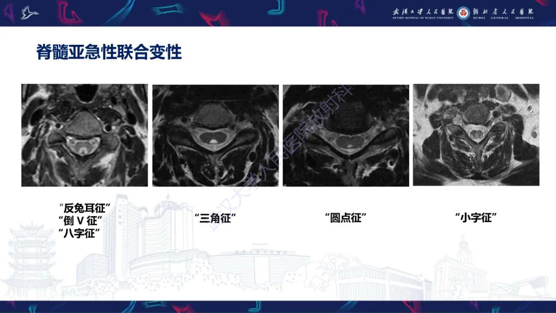 影像PPT - 【PPT】维生素B12缺乏神经影像诊断-19