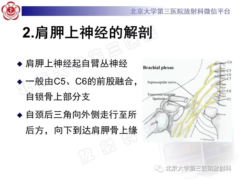 影像PPT - 【PPT】肩胛上神经卡压-7