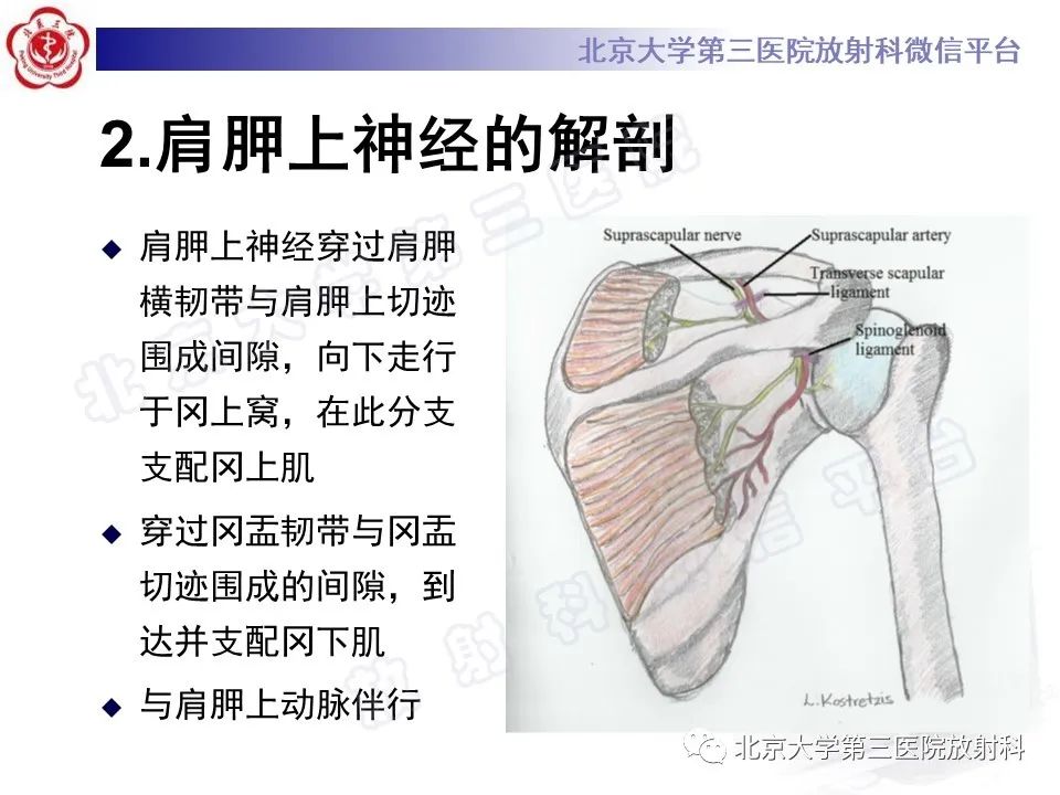 影像PPT - 【PPT】肩胛上神经卡压-8