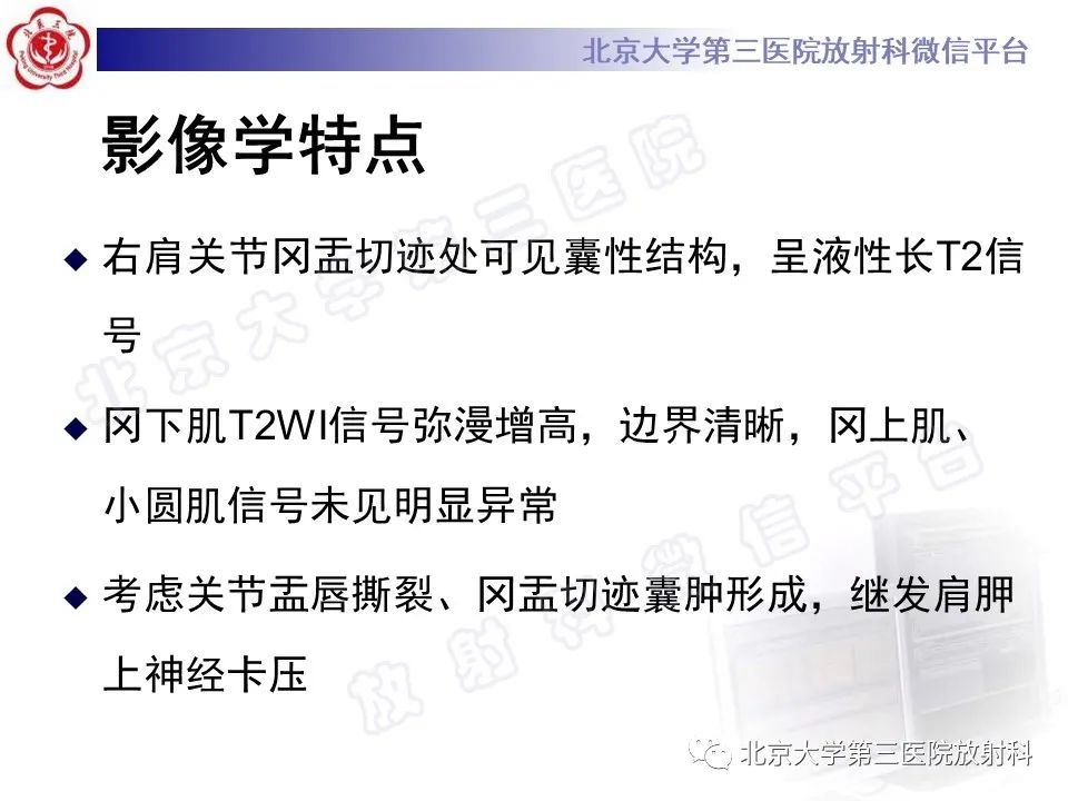 影像PPT - 【PPT】肩胛上神经卡压-4