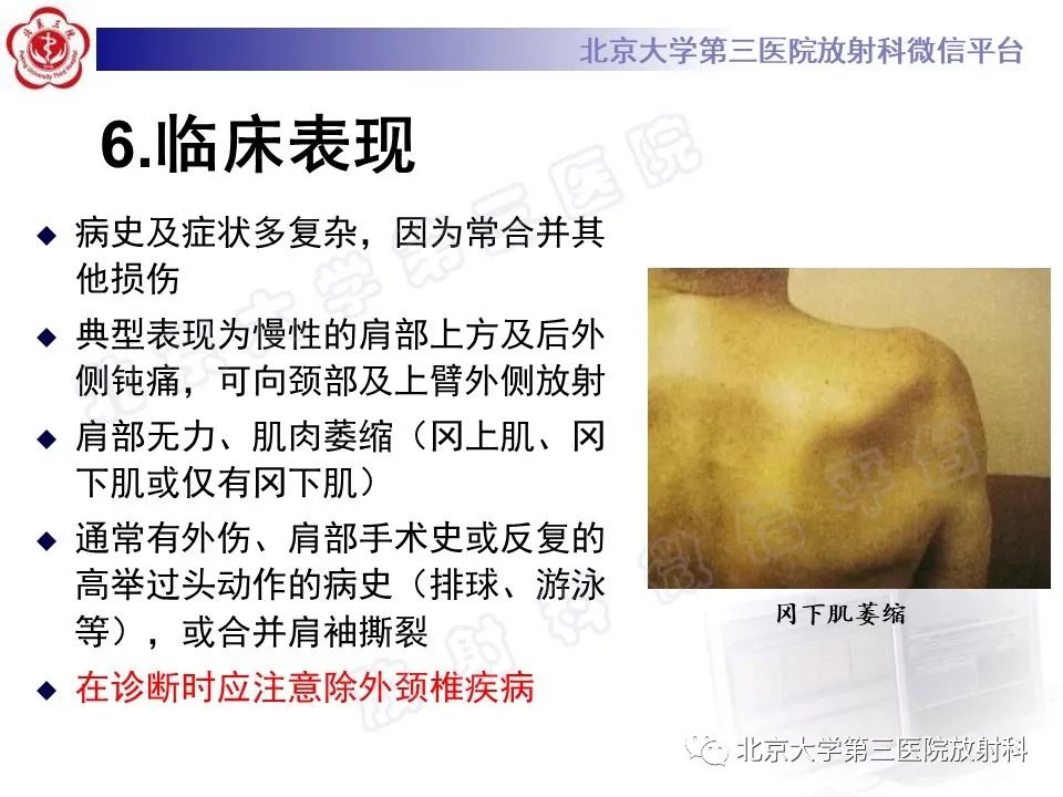 影像PPT - 【PPT】肩胛上神经卡压-15