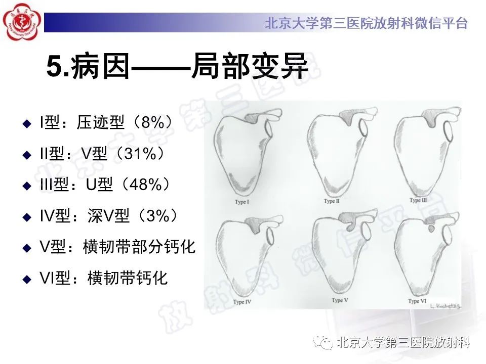 影像PPT - 【PPT】肩胛上神经卡压-12
