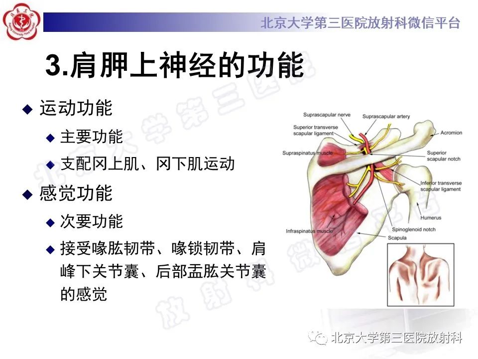 影像PPT - 【PPT】肩胛上神经卡压-9