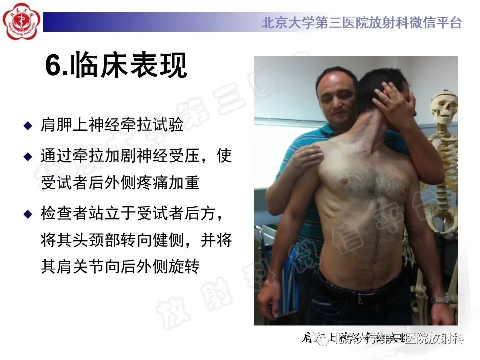 影像PPT - 【PPT】肩胛上神经卡压-16