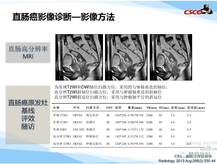 影像PPT - 直肠癌：MRI解剖、扫描规范、影像学评价、结构式报告-1