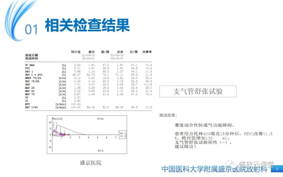 影像PPT - 【病例】弥漫性气管狭窄1例CT影像-3
