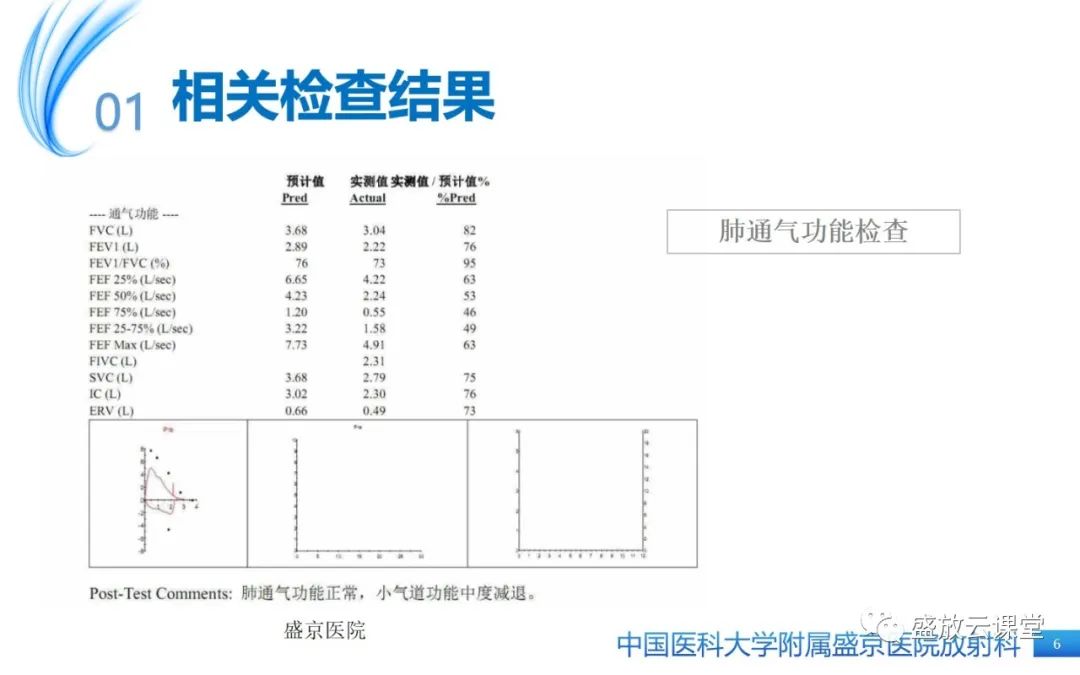 影像PPT - 【病例】弥漫性气管狭窄1例CT影像-6