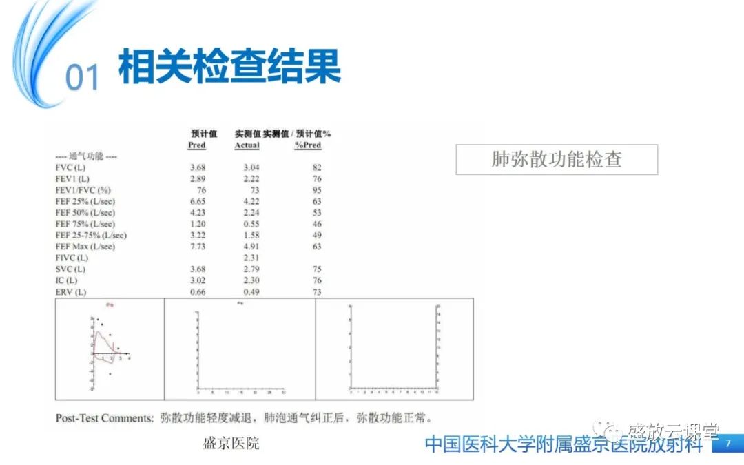 影像PPT - 【病例】弥漫性气管狭窄1例CT影像-7