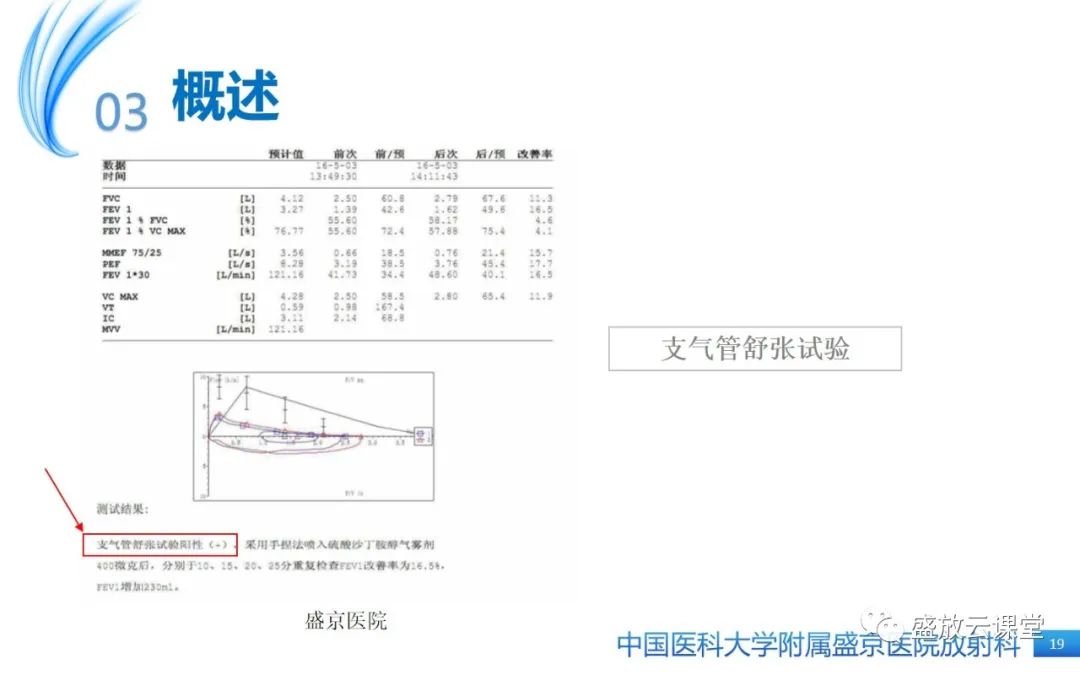 影像PPT - 【病例】弥漫性气管狭窄1例CT影像-19