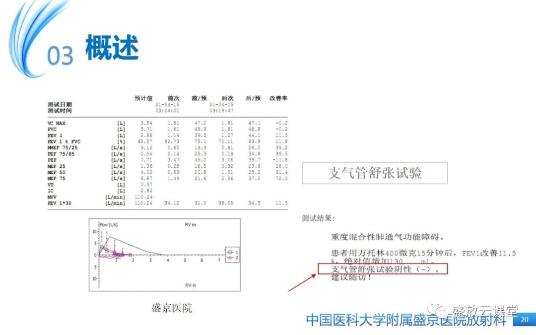 影像PPT - 【病例】弥漫性气管狭窄1例CT影像-20