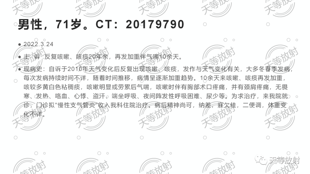 影像PPT - 【病例】胸腺非典型类癌1例CT影像-1 影像PPT - 【病例】胸腺非典型类癌1例CT影像-1