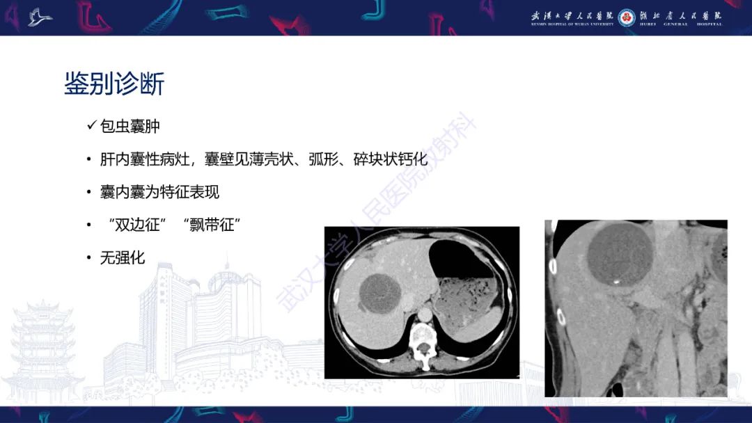 影像PPT - 【病例】肝脏未分化胚胎性肉瘤1例CT影像-30