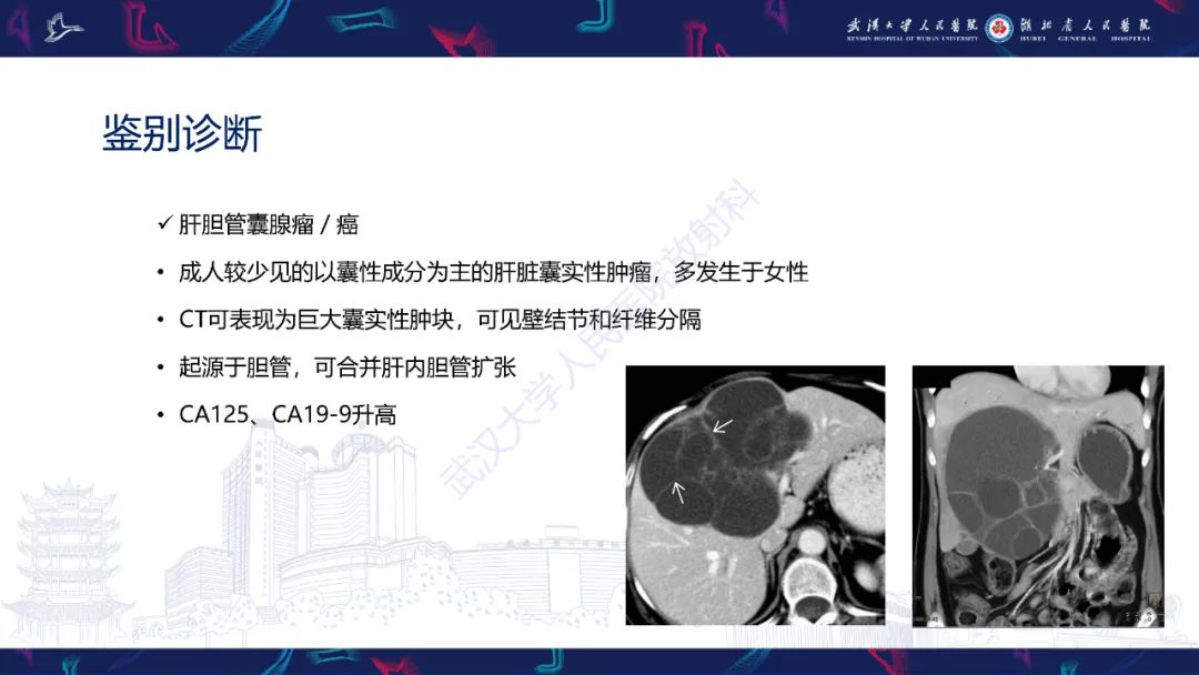 影像PPT - 【病例】肝脏未分化胚胎性肉瘤1例CT影像-28