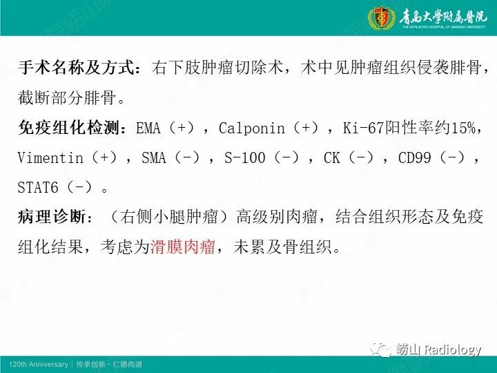 影像PPT - 【PPT】小腿滑膜肉瘤1例CT及MR影像-6