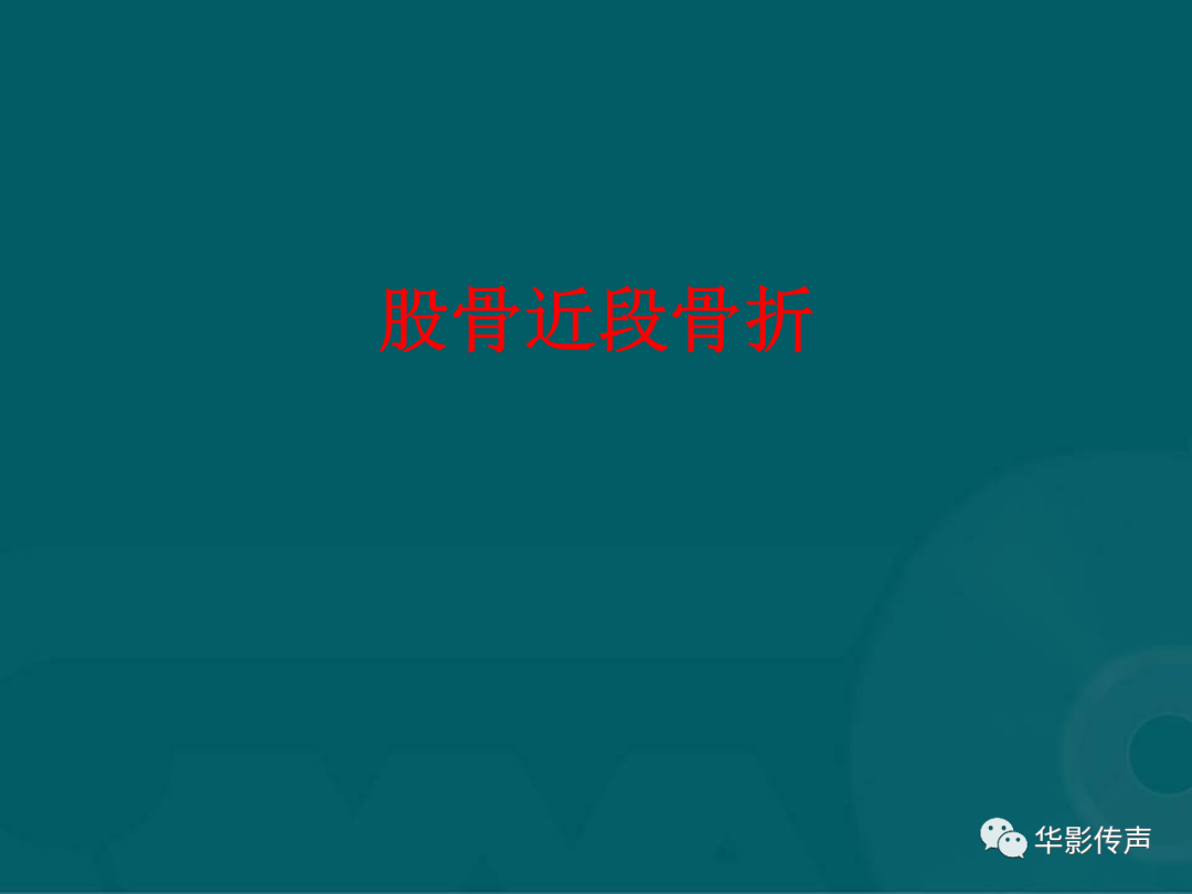 影像PPT - 【PPT】髋关节创伤的影像诊断-3 影像PPT - 【PPT】髋关节创伤的影像诊断-3