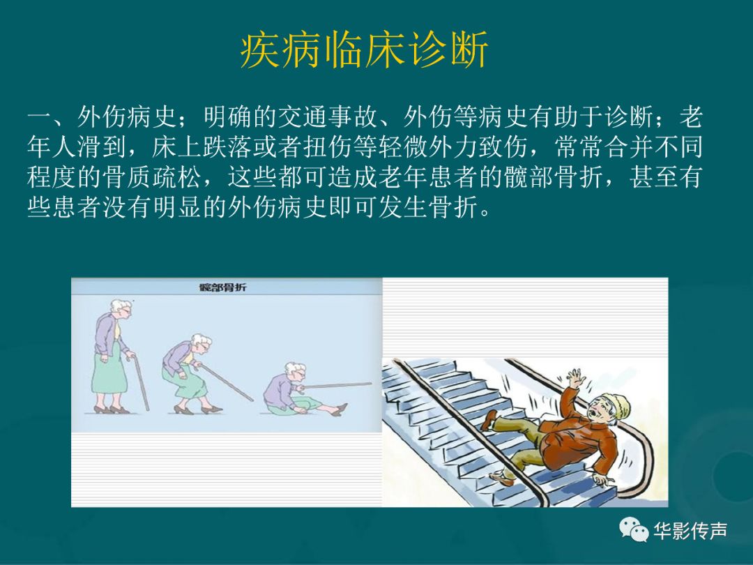 影像PPT - 【PPT】髋关节创伤的影像诊断-5 影像PPT - 【PPT】髋关节创伤的影像诊断-5