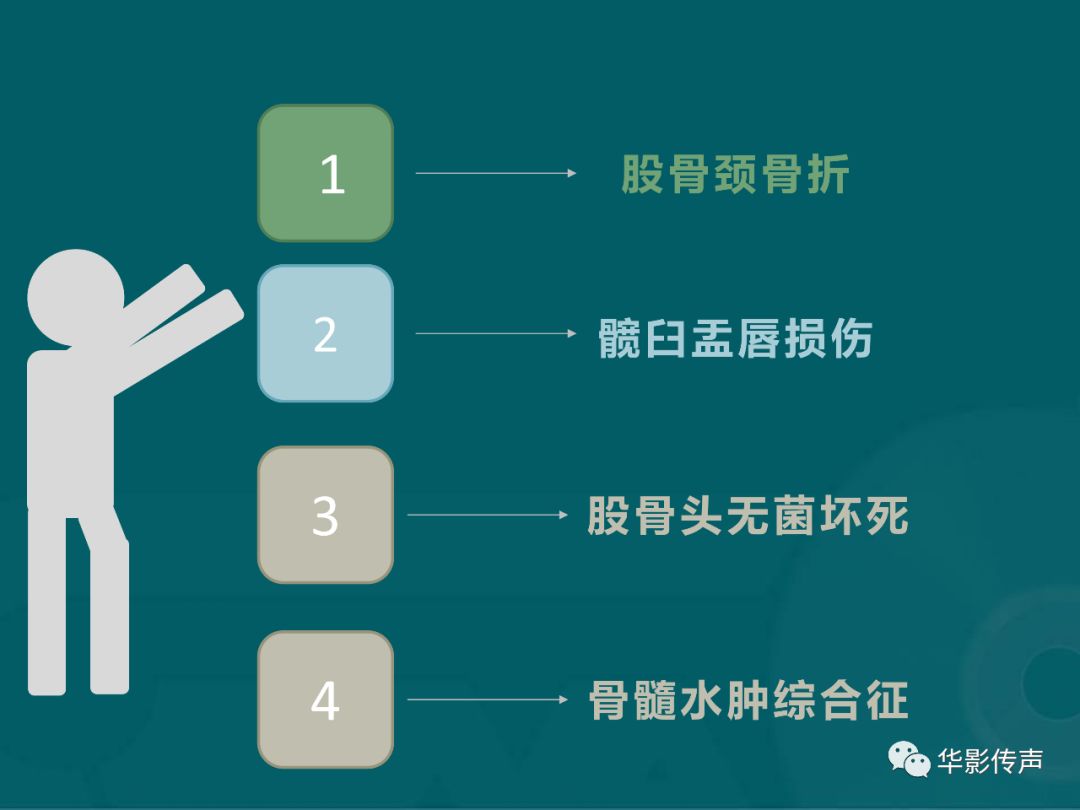 影像PPT - 【PPT】髋关节创伤的影像诊断-2 影像PPT - 【PPT】髋关节创伤的影像诊断-2