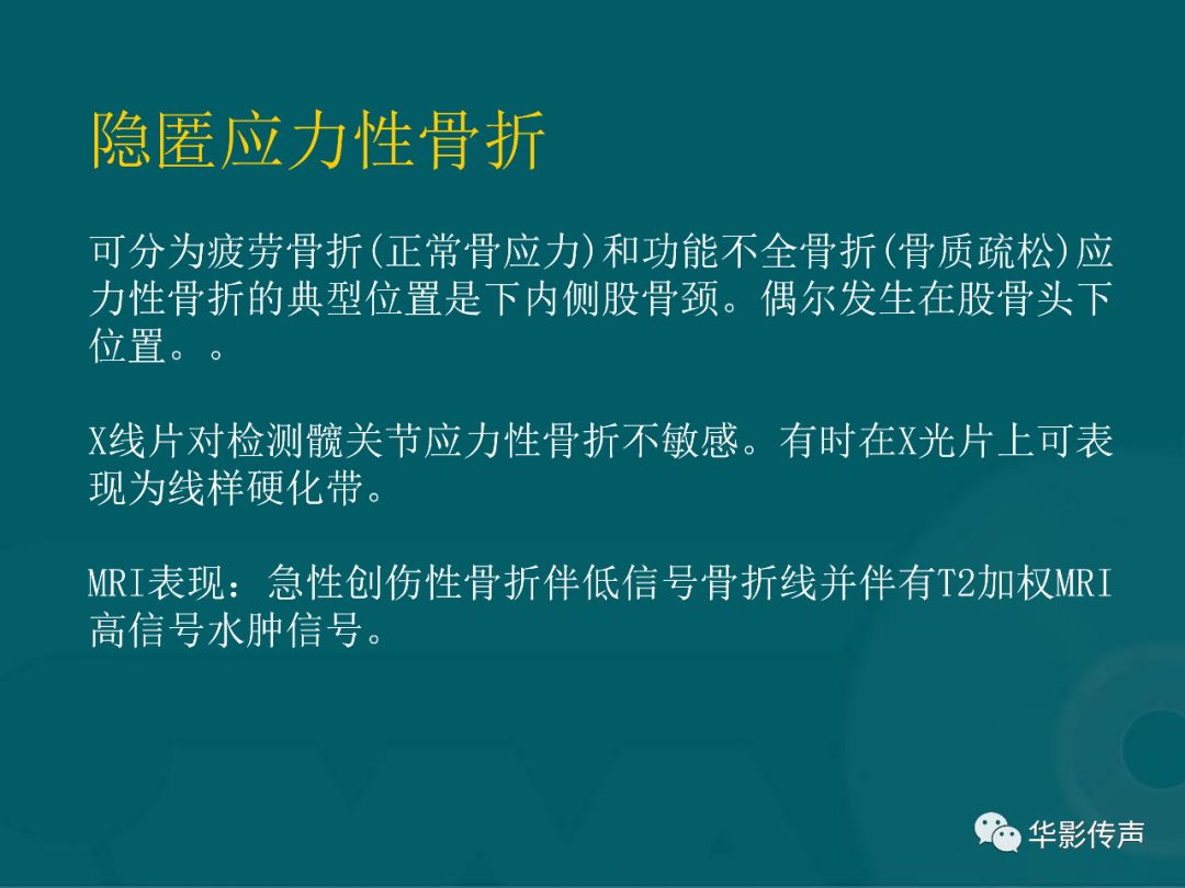 影像PPT - 【PPT】髋关节创伤的影像诊断-13 影像PPT - 【PPT】髋关节创伤的影像诊断-13