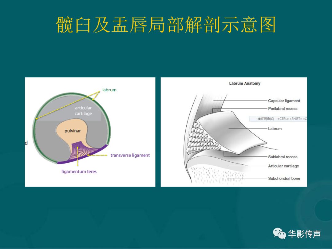 影像PPT - 【PPT】髋关节创伤的影像诊断-20 影像PPT - 【PPT】髋关节创伤的影像诊断-20