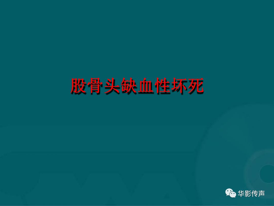 影像PPT - 【PPT】髋关节创伤的影像诊断-33 影像PPT - 【PPT】髋关节创伤的影像诊断-33