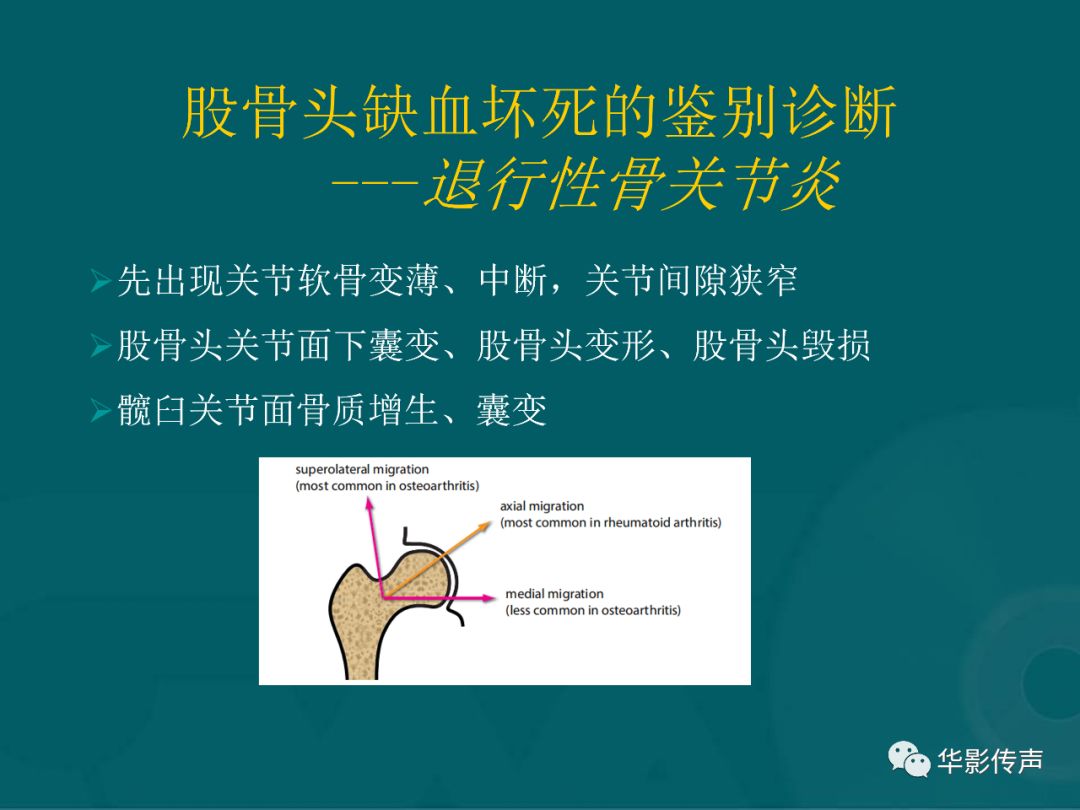 影像PPT - 【PPT】髋关节创伤的影像诊断-55 影像PPT - 【PPT】髋关节创伤的影像诊断-55