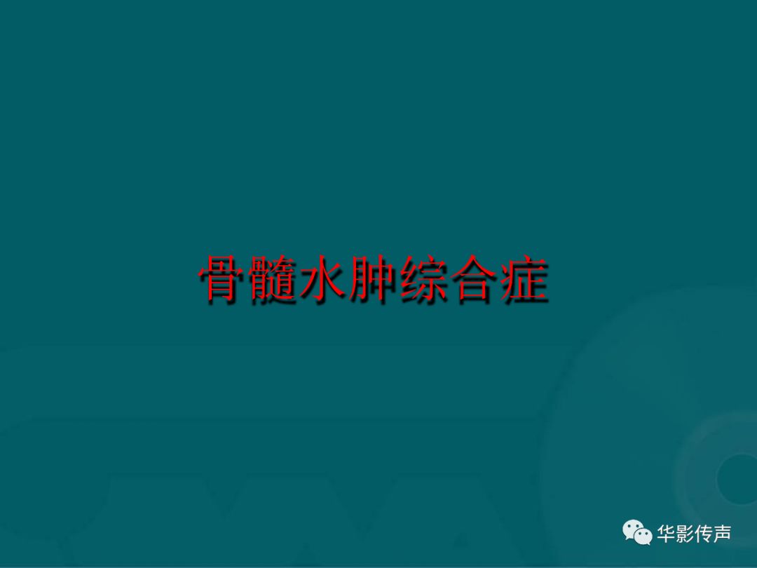 影像PPT - 【PPT】髋关节创伤的影像诊断-58 影像PPT - 【PPT】髋关节创伤的影像诊断-58