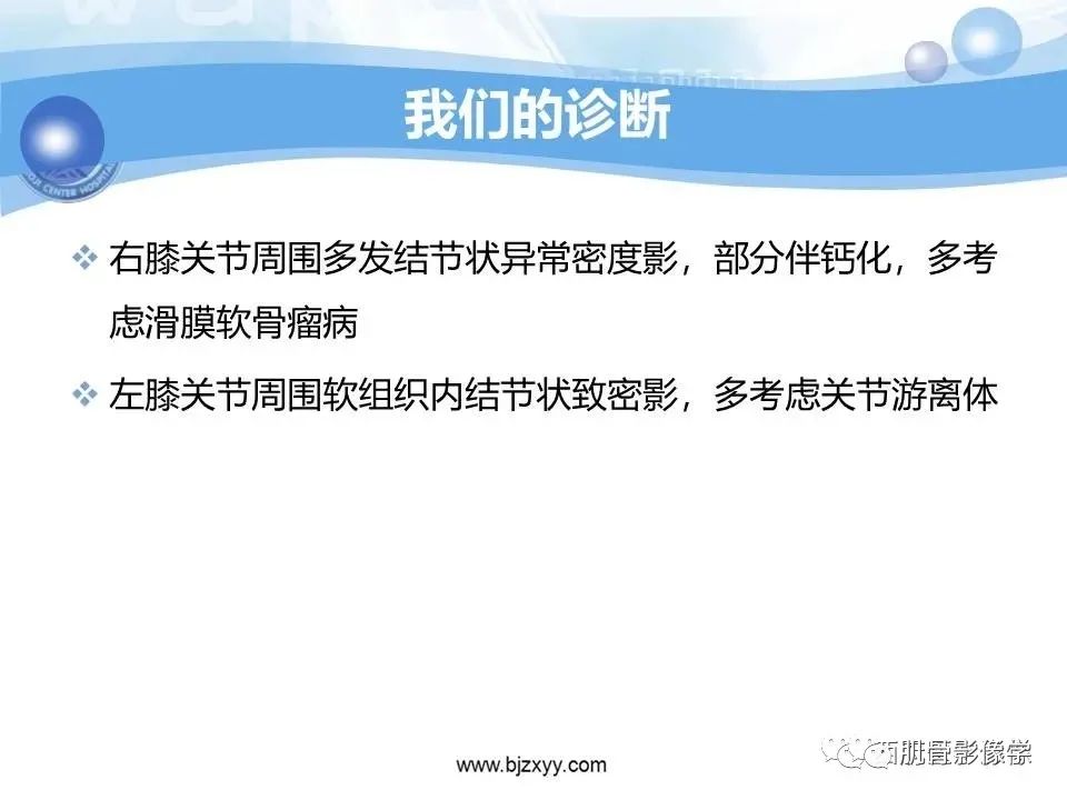 影像PPT - 【PPT】滑膜软骨瘤病与游离体-7
