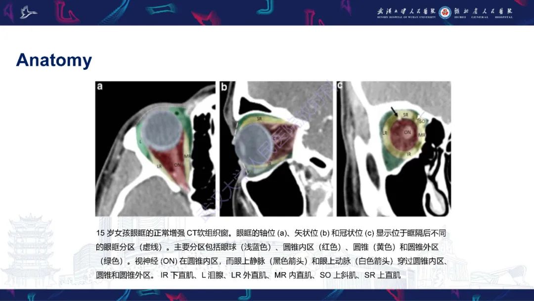 影像PPT - 【PPT】儿童眼眶感染性及炎性病变影像诊断-6