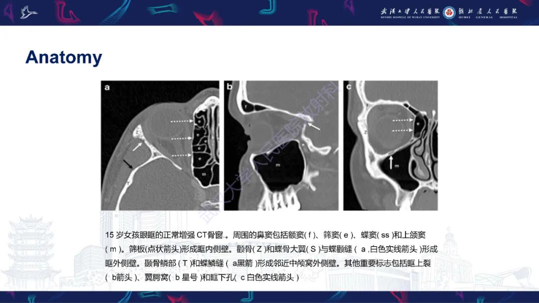 影像PPT - 【PPT】儿童眼眶感染性及炎性病变影像诊断-7