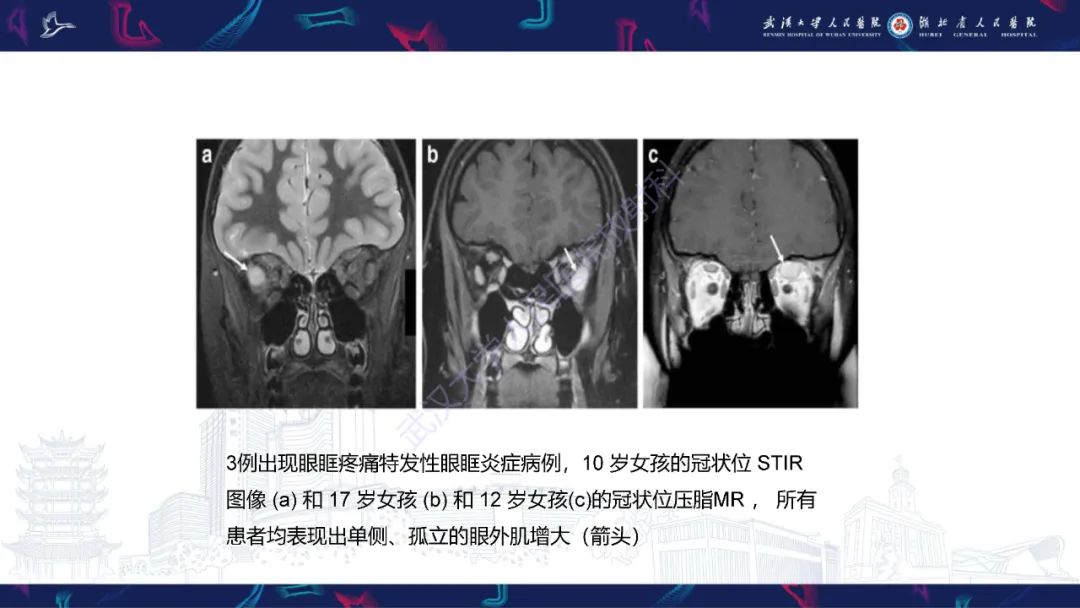 影像PPT - 【PPT】儿童眼眶感染性及炎性病变影像诊断-39