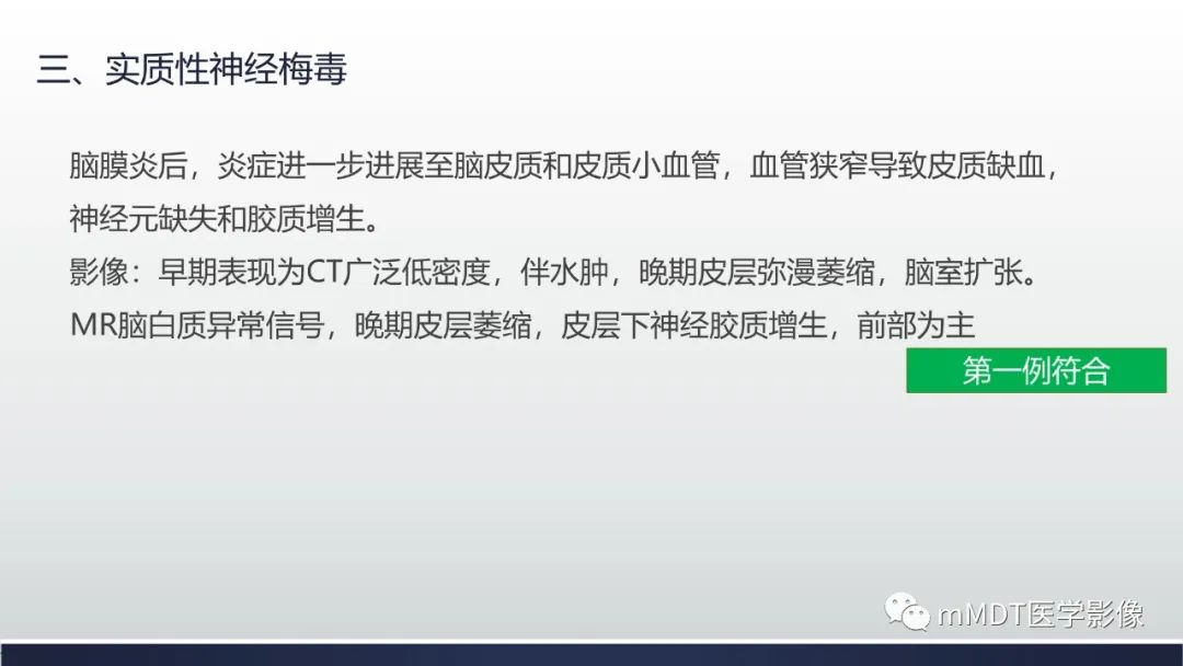 影像PPT - 【PPT】神经梅毒病例分析及图文综述-57