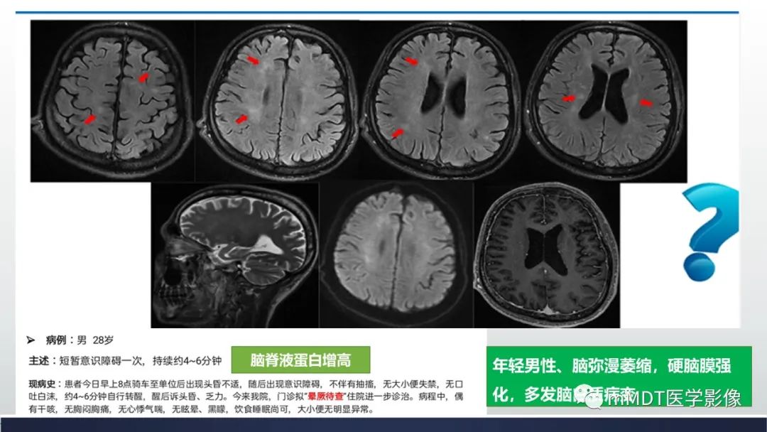 影像PPT - 【PPT】神经梅毒病例分析及图文综述-60