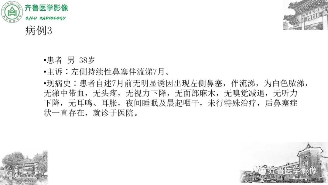 影像PPT - 【病例】鼻咽纤维血管瘤3例CT及MR影像-16