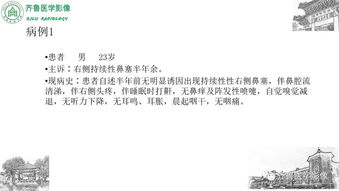 影像PPT - 【病例】鼻咽纤维血管瘤3例CT及MR影像-2