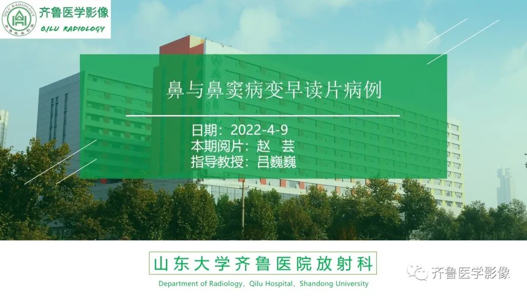 影像PPT - 【病例】鼻咽纤维血管瘤3例CT及MR影像-1