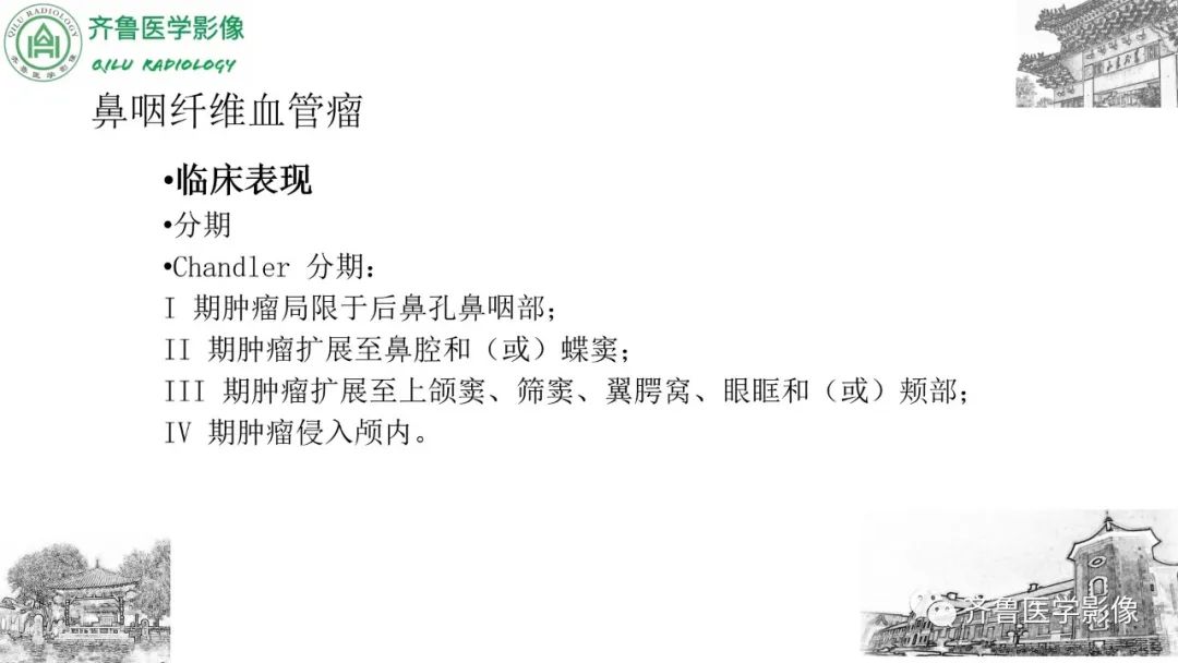 影像PPT - 【病例】鼻咽纤维血管瘤3例CT及MR影像-26