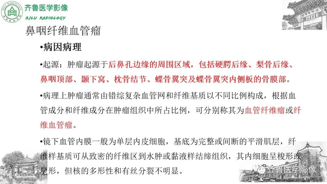 影像PPT - 【病例】鼻咽纤维血管瘤3例CT及MR影像-24