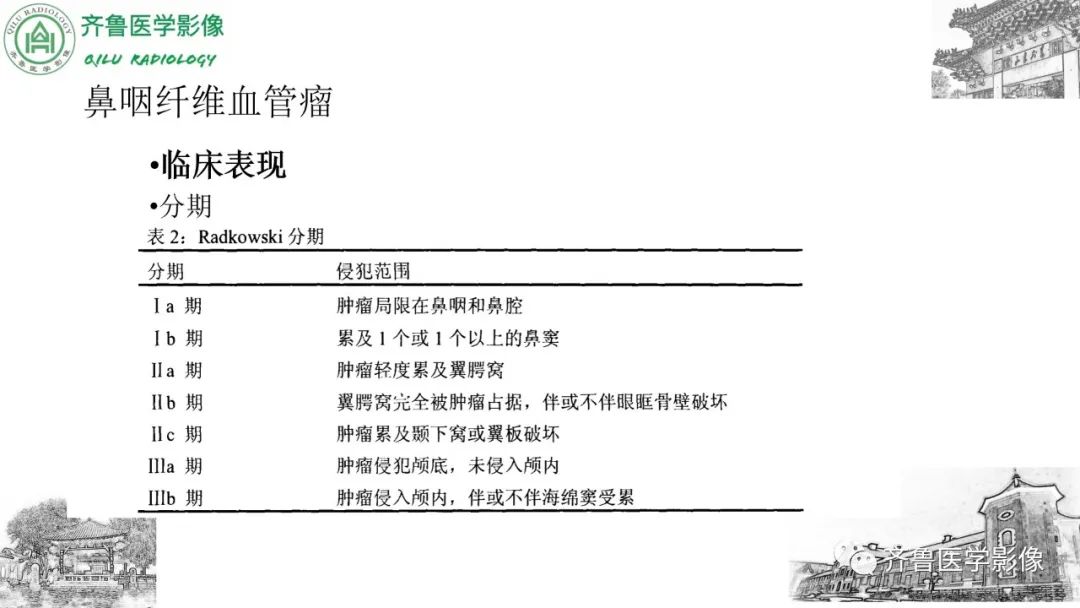 影像PPT - 【病例】鼻咽纤维血管瘤3例CT及MR影像-27