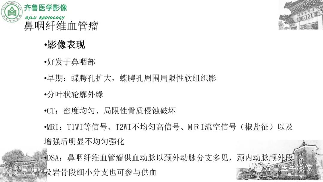 影像PPT - 【病例】鼻咽纤维血管瘤3例CT及MR影像-28