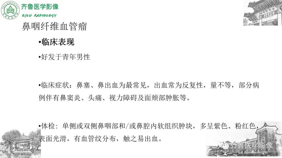 影像PPT - 【病例】鼻咽纤维血管瘤3例CT及MR影像-25