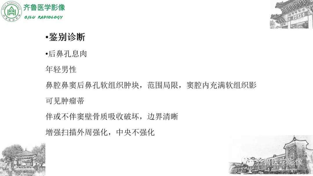 影像PPT - 【病例】鼻咽纤维血管瘤3例CT及MR影像-31