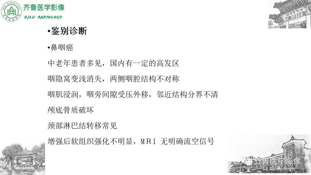 影像PPT - 【病例】鼻咽纤维血管瘤3例CT及MR影像-29