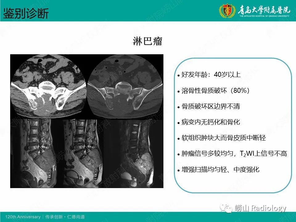 影像PPT - 【病例】胸椎脊索瘤1例CT及MR影像-13