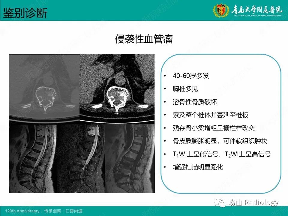 影像PPT - 【病例】胸椎脊索瘤1例CT及MR影像-11