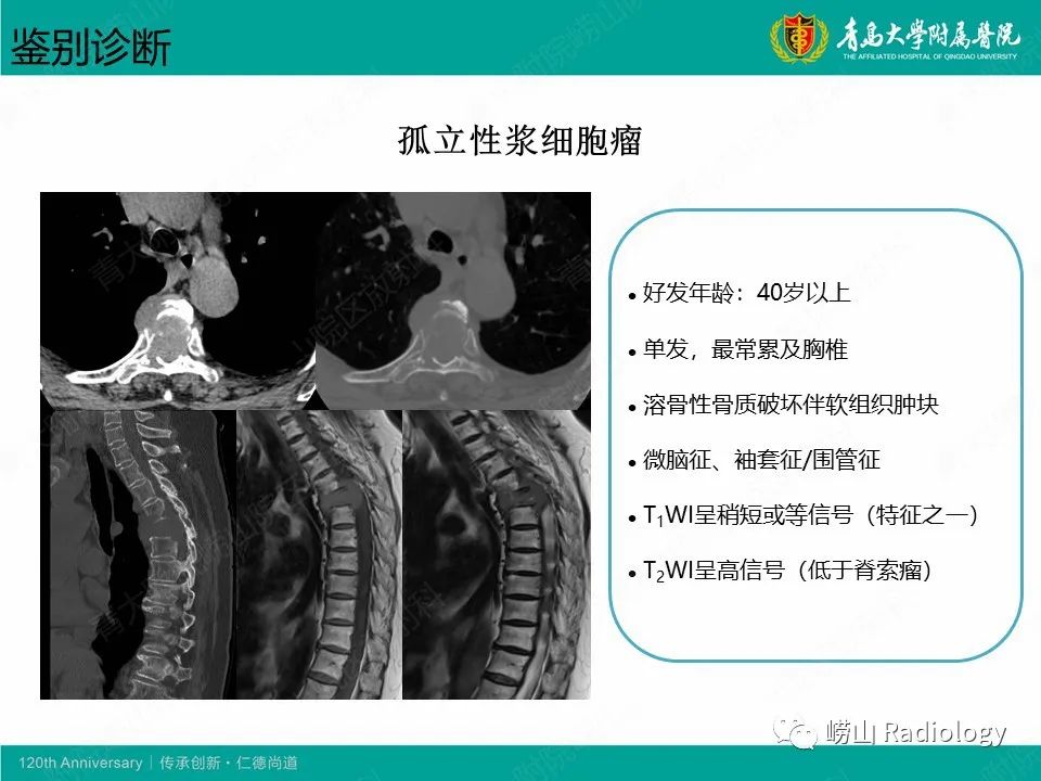 影像PPT - 【病例】胸椎脊索瘤1例CT及MR影像-12