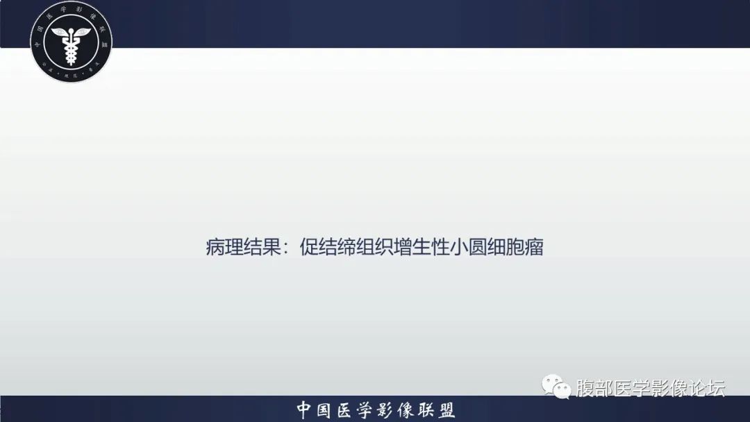 影像PPT - 【病例】促结缔组织增生性小圆细胞肿瘤DSRCT一例影像诊断-7